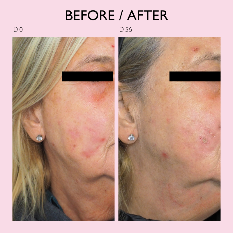 ROSAE MOISTURIZING EMULSION